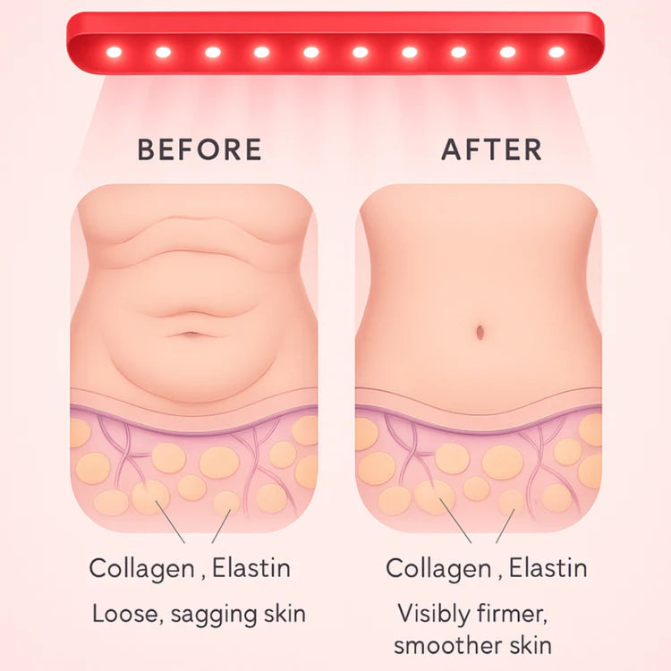 Red Light Therapy Belt for Loose Skin