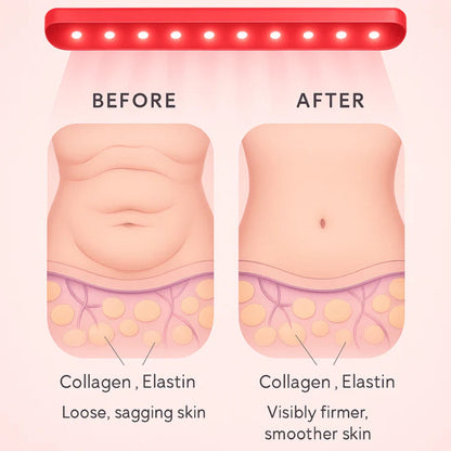 Red Light Therapy Belt for Loose Skin & Core Recovery